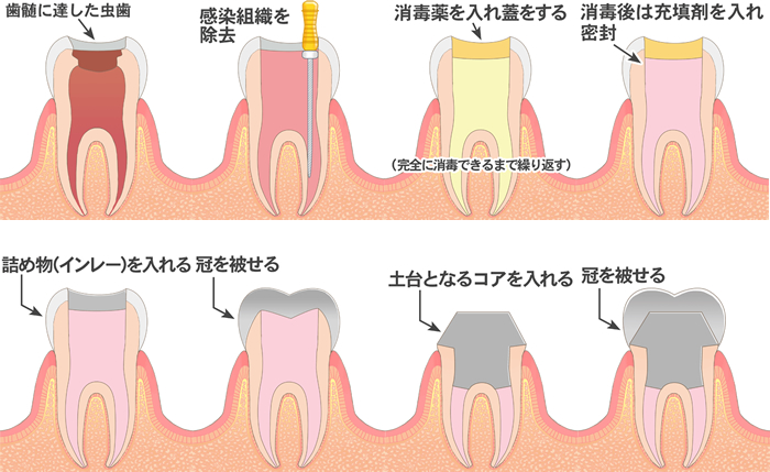 歯科 単 治 と は